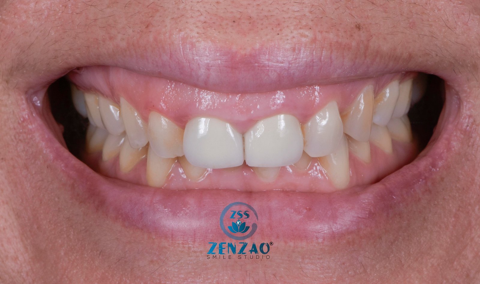 Zenzaosmilestudio_DSC0304 – copia Zenzaosmilestudio_DSC0304 - copia