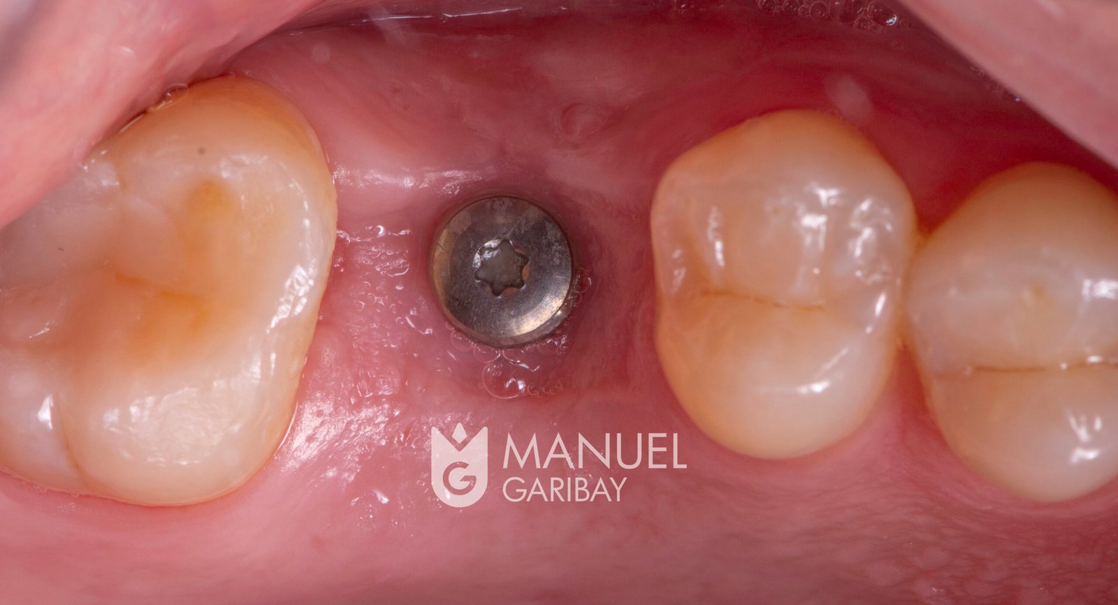 drmanuelgaribay_DSC8021 drmanuelgaribay_DSC8021