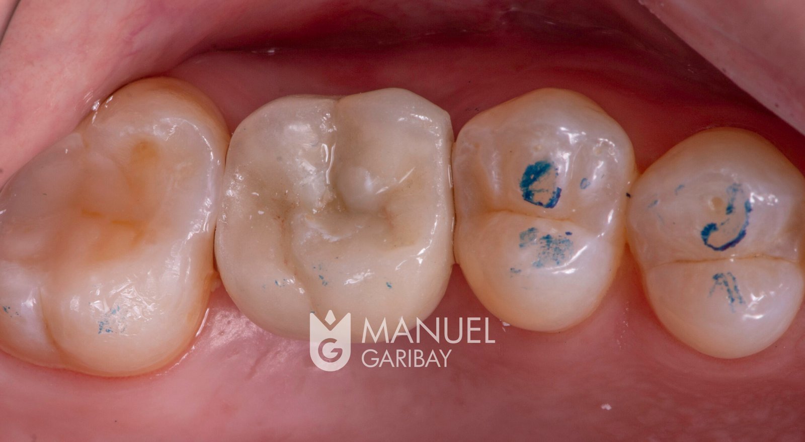 drmanuelgaribay_DSC8024 drmanuelgaribay_DSC8024