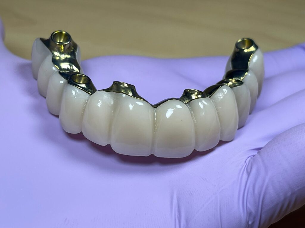 Protesis PMMA zirconia 1