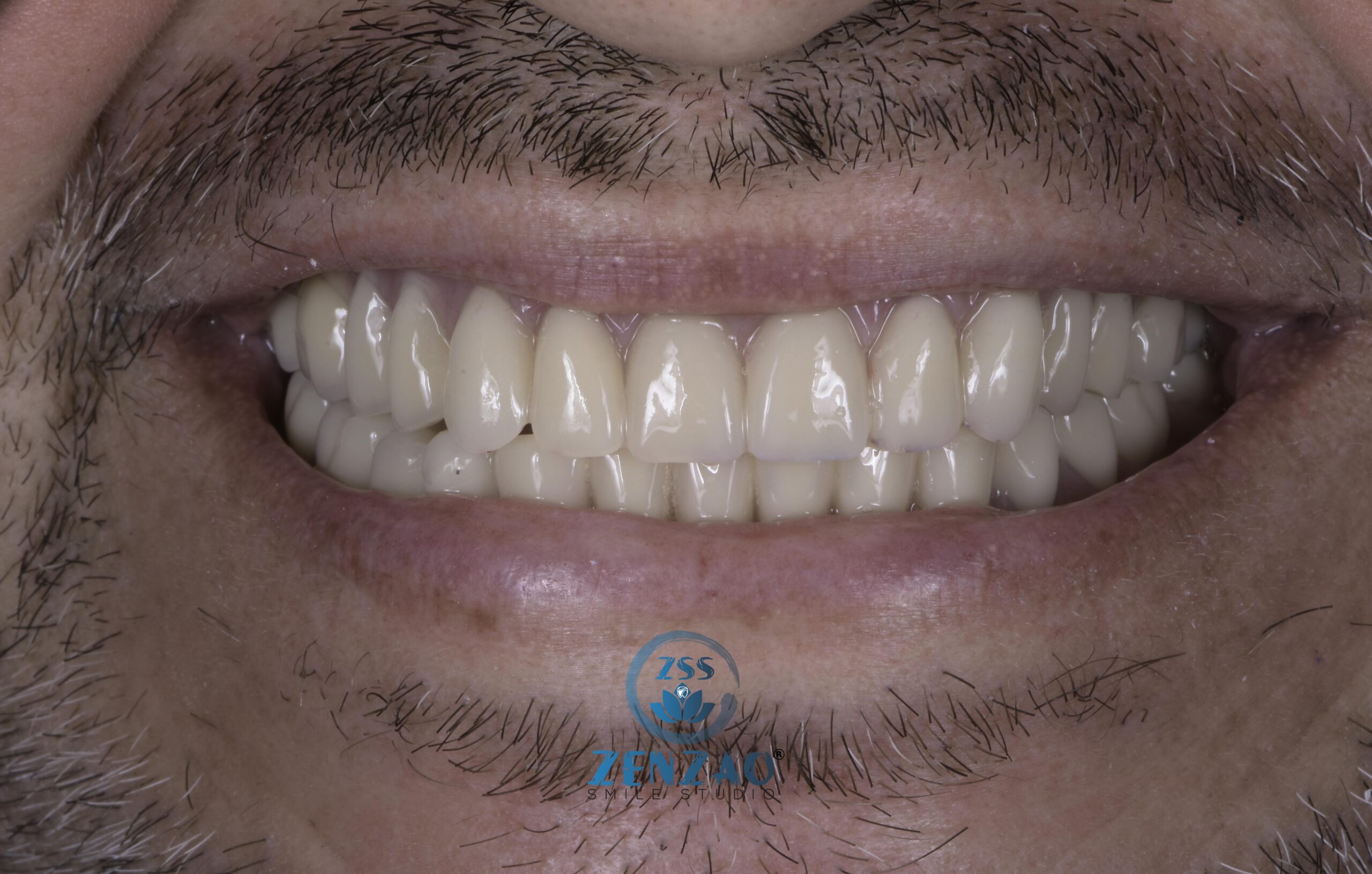 zenzaosmilestudio_DSC0490