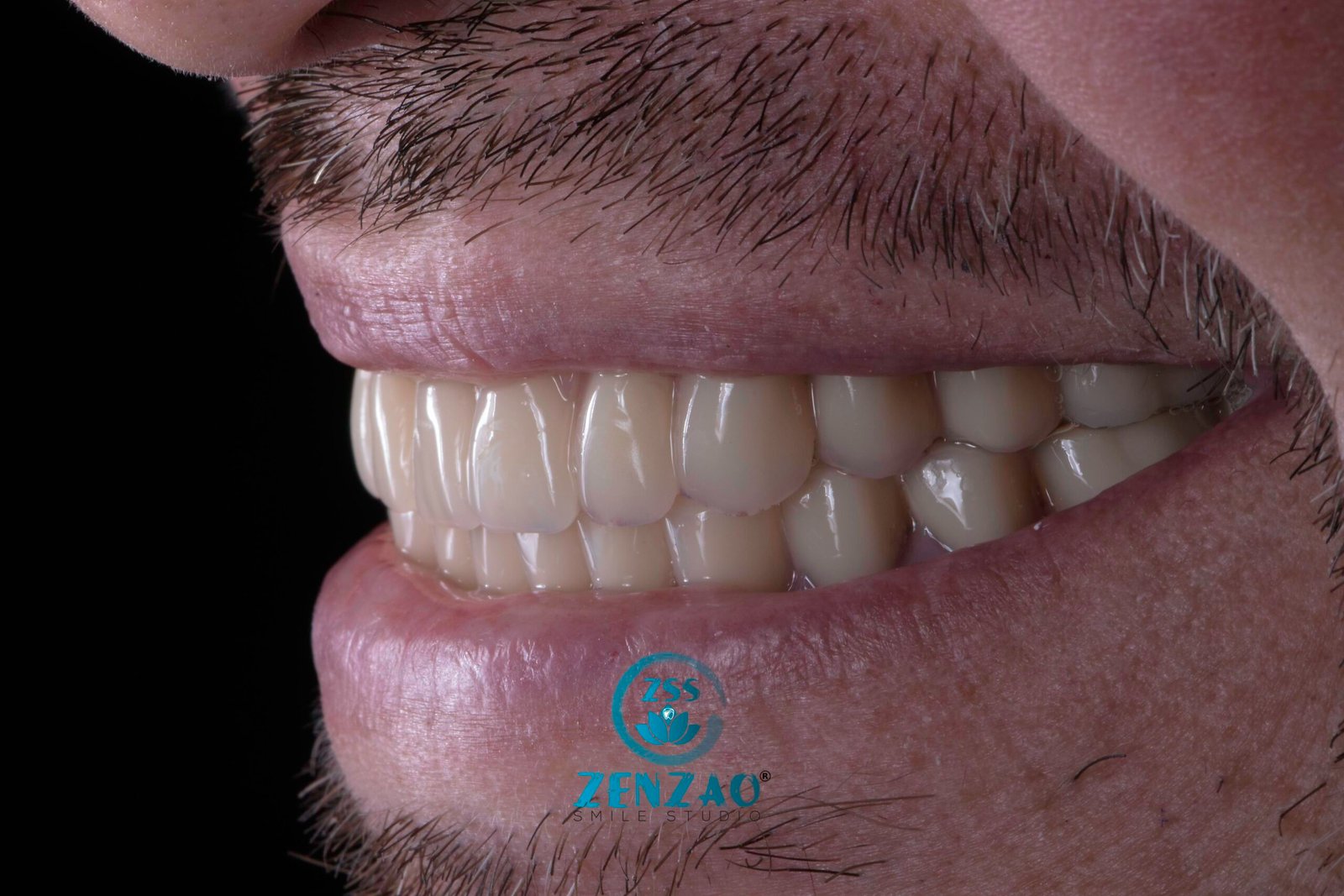 zenzaosmilestudio_DSC0494 zenzaosmilestudio_DSC0494