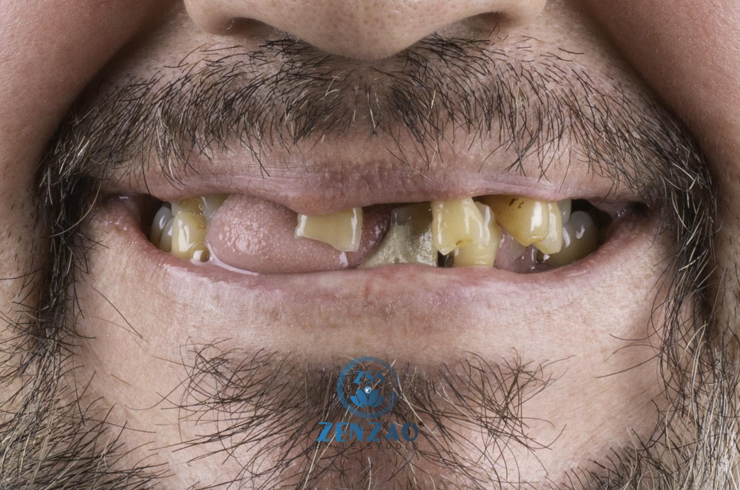 zenzaosmilestudio_DSC9354-2