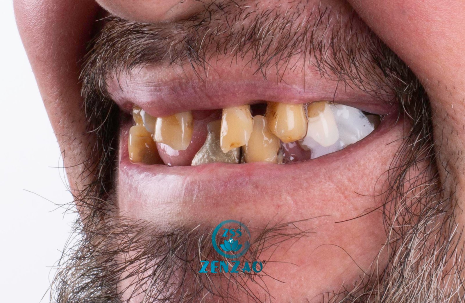 zenzaosmilestudio_DSC9356-2 zenzaosmilestudio_DSC9356-2